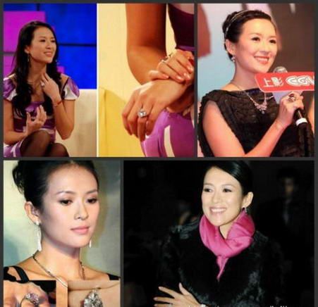 女星“鸽子蛋”到底值多少钱